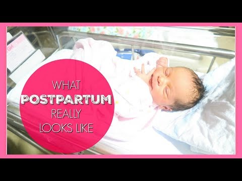 Kung gaano katagal matapos caesarean ay posible pa rin upang alisin ang taba ng tiyan Binti mangayayat mas mabilis