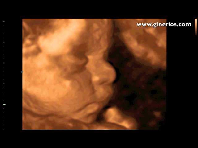 Ecografia 3d Y 4d En Cordoba Las 10 Mejores Clinicas Mundofertilidad