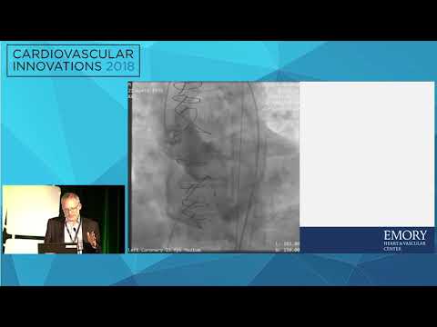 CVI2018 Session: Difficult transcaval therapy - Adam Greenbaum, MD