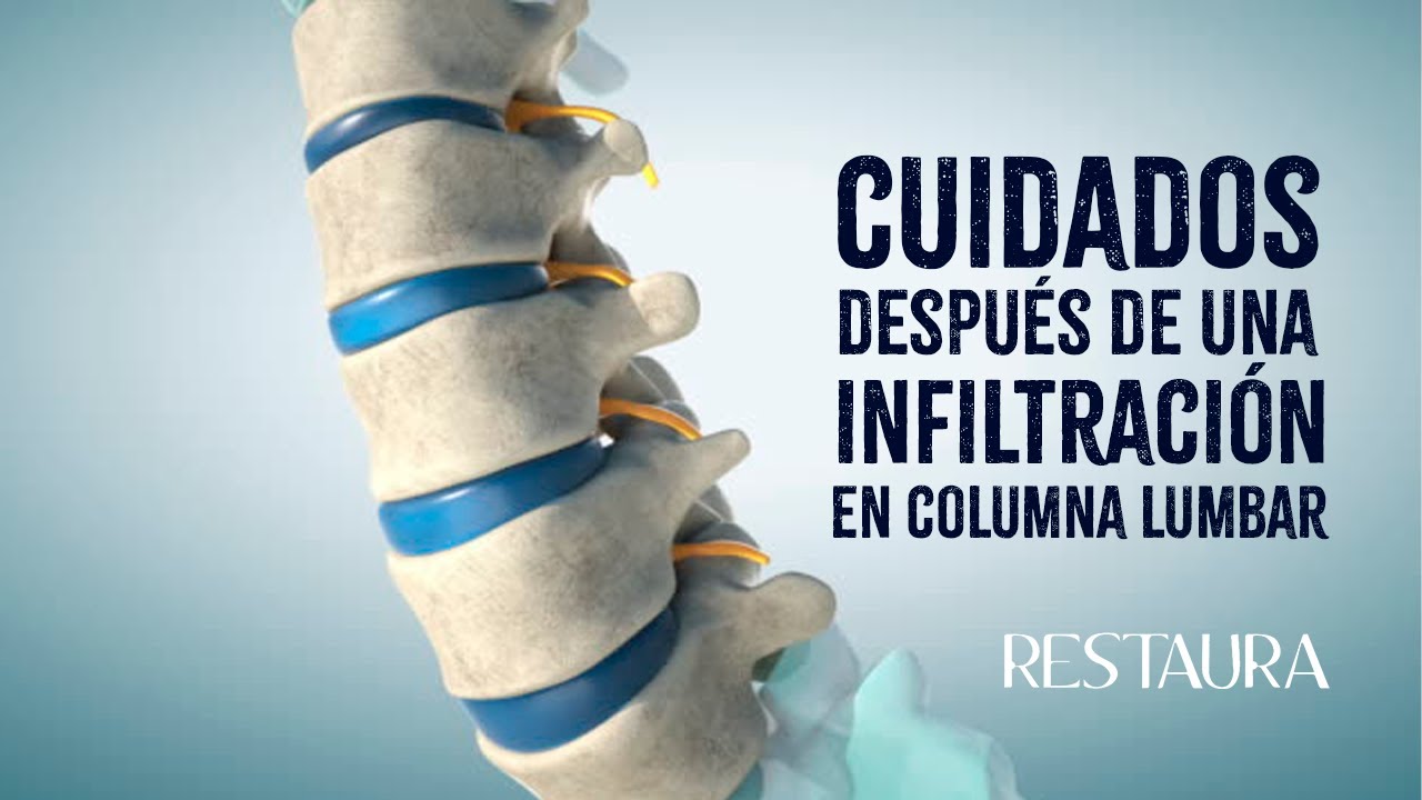 Watch Cuidados después de una infiltración en columna lumbar Now Cuidados después de una infiltración en columna lumbar