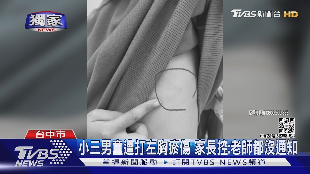 小三男童遭打左胸瘀傷 家長控:老師都沒通知