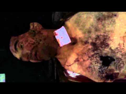 جثمان محمود محمد المفلس في مدينة دوما في محافظة ريف دمشق