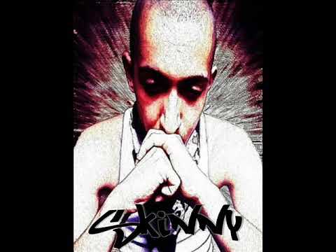 Skinny - Дори И Беден Да Съм (2013) (Official Release)