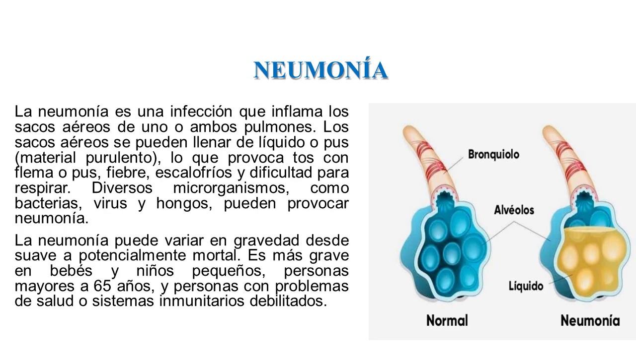 Putar video CUIDADOS EN PROBLEMAS RESPIRATORIOS sekarang CUIDADOS EN PROBLEMAS RESPIRATORIOS