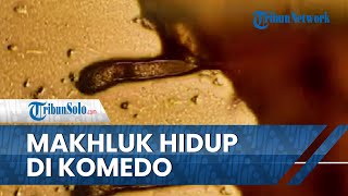 Viral Video Penampakan Makhluk Hidup Bersarang di Komedo & Terlihat di Mikroskop, Ini Penjelasannya