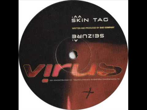 Skin Tag