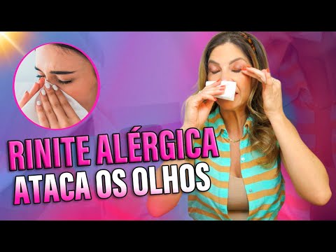 Allergic Rhinitis in the Eyes. How to Improve It?