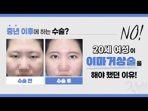 #이마거상술 20세 젊은 여성이 하게 된 이유!
