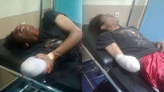 Tangkis Tebasan ke Arah Kepalanya, Tangan Pemuda di Cianjur Terputus Ditebas Gerombolan Bermotor
