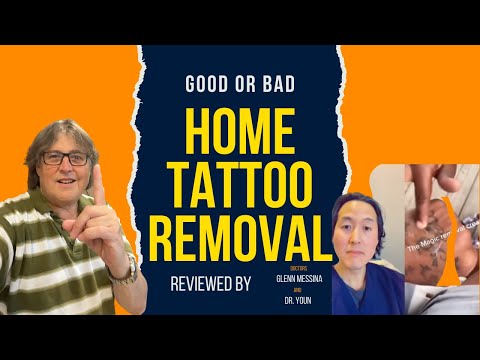 Home tattoo Removal Using Salt  Reviewed by Dr. Messina & Dr. Youn, Is It Safe?