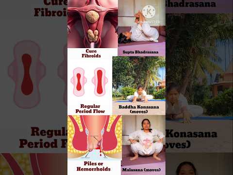 Cure PCOD/PCOS | Regular Period Flow | Cure Piles/Hemorrhoids | Balance Hormones Naturally #yoga