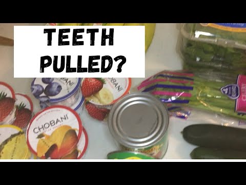 What to Eat After Tooth Extraction | Survival Guide I Just Had Teeth Extracted