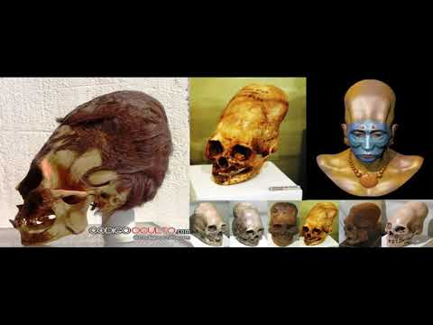 HIPNOSIS OZIEL MORENO MTY. MEXICO