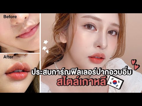 ฉีด ฟิลเลอร์ ปาก