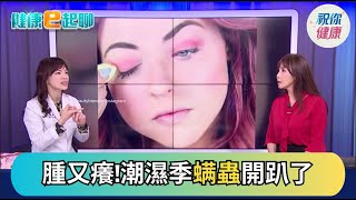 變天又開始"紅腫癢"元兇是「牠」？