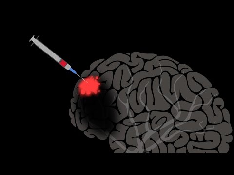 Dolore dellarticolazione dellanca Dolore ai lati della schiena durante le mestruazioni