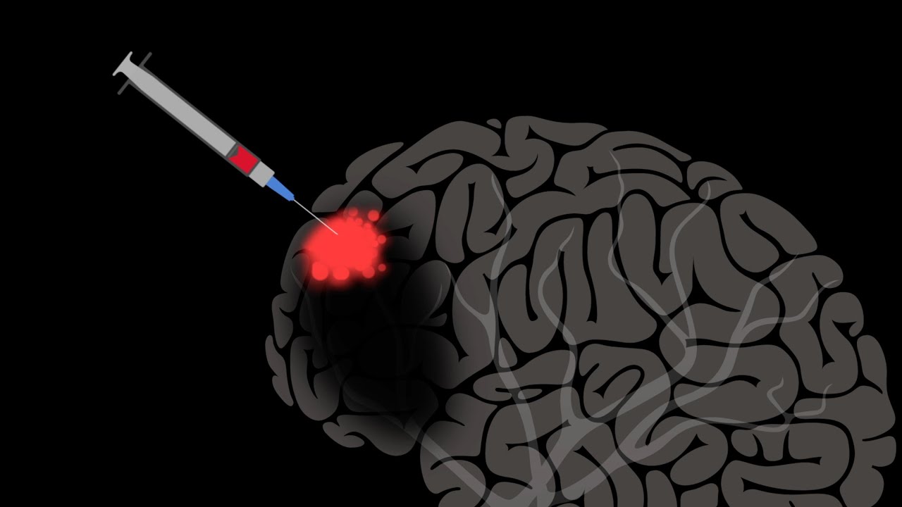The brain may be able to repair itself -- with help | Jocelyne Bloch