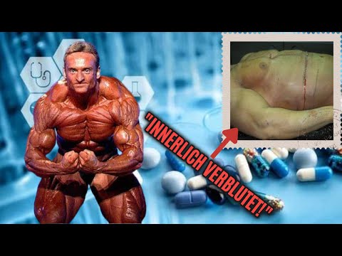 The worst deaths in bodybuilding - The last moments in the lives of young bodybuilders