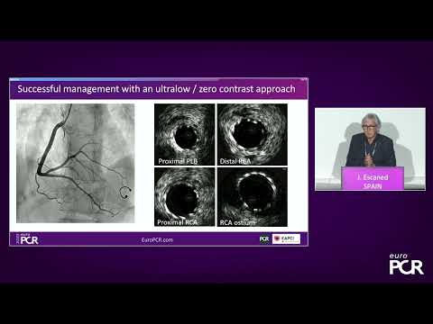 Ultra-low contrast PCI - An indispensable toolset in complex coronary interventions - EuroPCR 2023