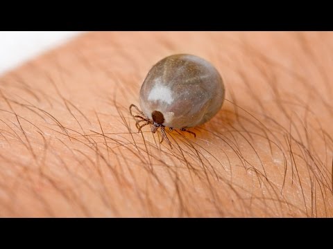 Gefahr durch Zecken: Vorsicht vor den kleinen Plagegeistern