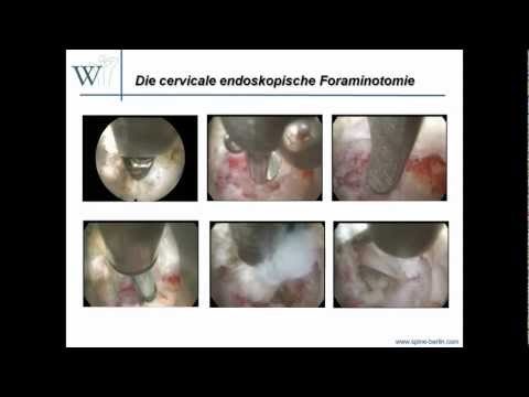 Schmerzen und Schwellungen der Kniebehandlung Orthese Kniegelenk Speisekammer Gesundheit