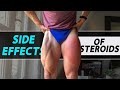 The Dark Side Of Taking Steroids | Side Effects