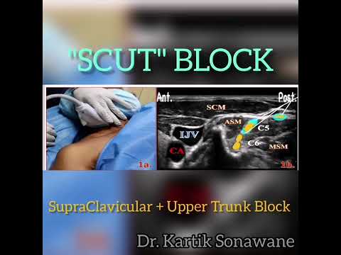 "SCUT" Block