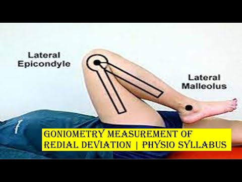 How to get Goniometry Measurements | Physio Syllabus