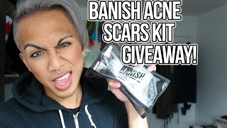 BANISH ACNE SCARS KIT GIVEAWAY! | PAUL ZEDRICH