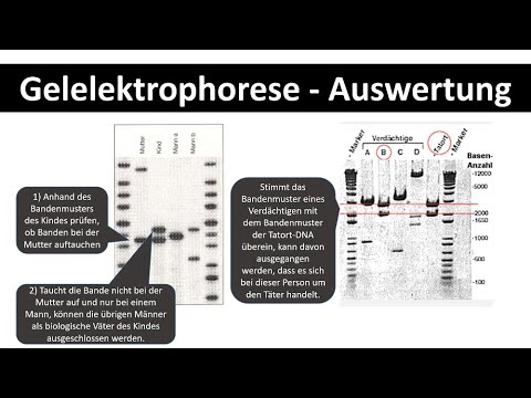 Gel electrophoresis - Evaluation / Application tasks [Paternity test] - [Biology, upper secondary...