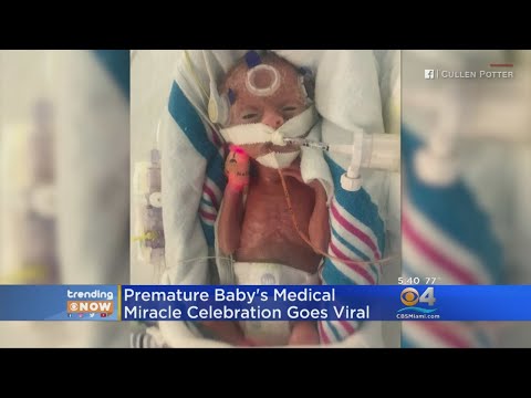 Trending: Premature Baby Celebrates