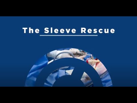 Revise a Failed Gastric Sleeve Surgery With The Sleeve Rescue at OCC