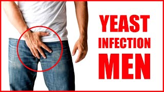 Yeast Infection in Men – Male Yeast Infection Symptoms | Thrush Fungal Infection in Private Parts