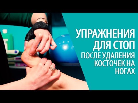 Wskazówki na palec z kamienia Jak leczyć guzek na kciuku nóg at home
