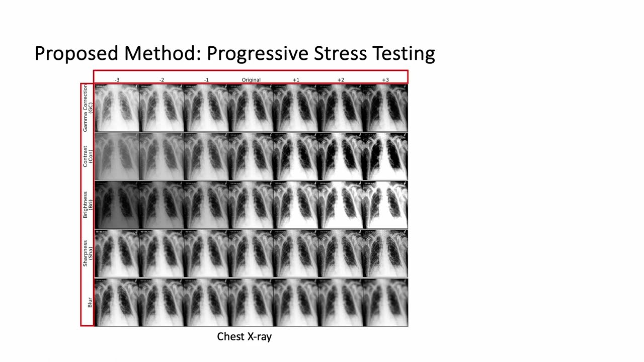 Robustness Stress Testing in Medical Image Classification - Mobarakol Islam