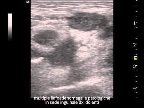 Ginnastica di video cervicale Esercizi per la schiena per alleviare il dolore