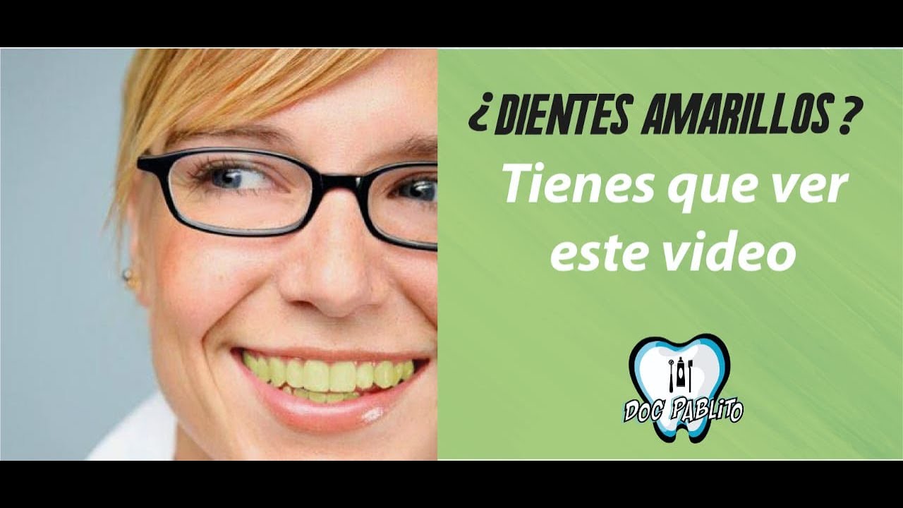 Pablo Duran Liceaga-14