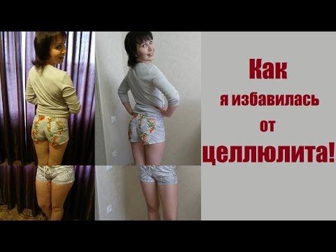 Как я избавилась от целлюлита с #elev8 // [B-Epic] [Надежда Дручинина]