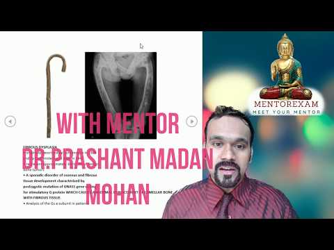 Orthopaedics Theory Memory Course Dr.Prashant Madan Mohan Mentorexam.com  DNB MS final FNB NEETSS