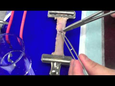 2012,02,03   Vascular Anastomosis