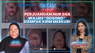 Perjuangan Nur Sha, Wajah 'Gosong' Dampak Krim Merkuri