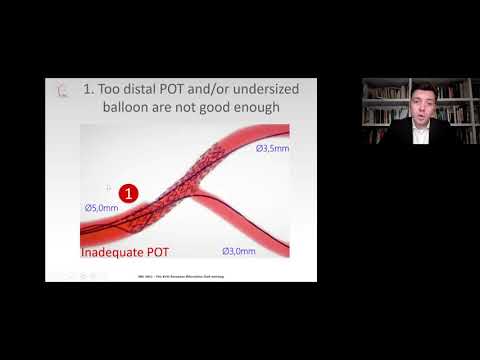 TERUMO SYMPOSIUM: Mastering POT with Ultimaster Stent