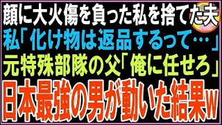 【スカッと】顔に大火傷を負った私を捨てた夫私「化け物は返品するって…」元特殊部隊の父「後悔さ?
