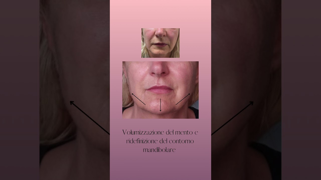 Giovanni Migliorini-9