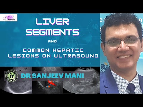 Master Liver Ultrasound: Segments, Lesions & Key Imaging Signs | Radiology Guide by Dr Sanjeev Mani