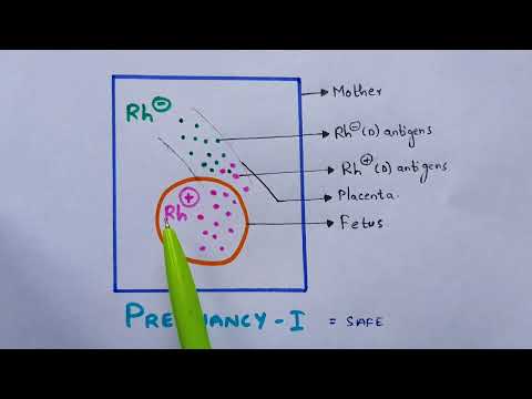 Typhoid fever Salmonella typhi Causes symptoms diagnosis treatment Bio science