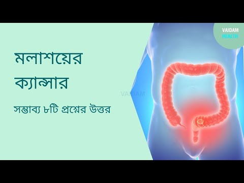 কোলন ক্যান্সার- ৮ টি প্রায়শই জিজ্ঞাসিত প্রশ্ন
