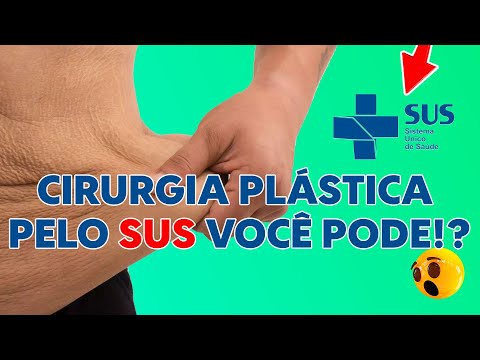 CIRURGIA PLASTICA PELO SUS VOCÊ PODE