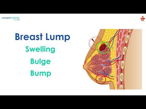 Breast lump | Manipal Hospitals Bengaluru