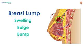 Breast lump | Manipal Hospitals Bengaluru